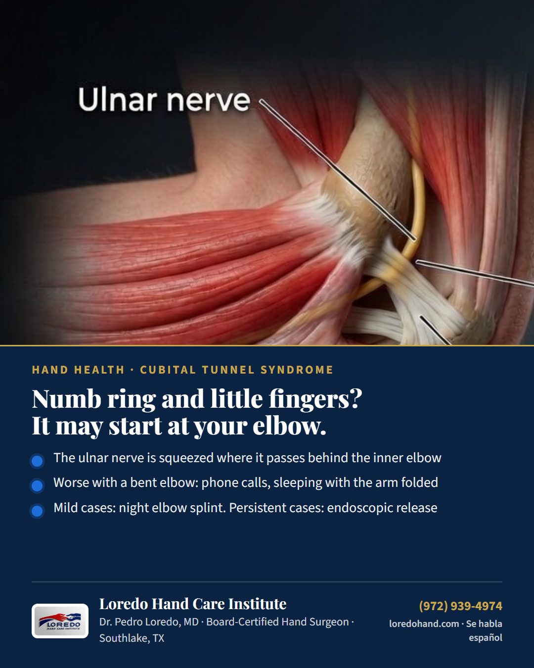 Numb ring and little fingers? It may start at your elbow. Loredo Hand Care Institute patient education card