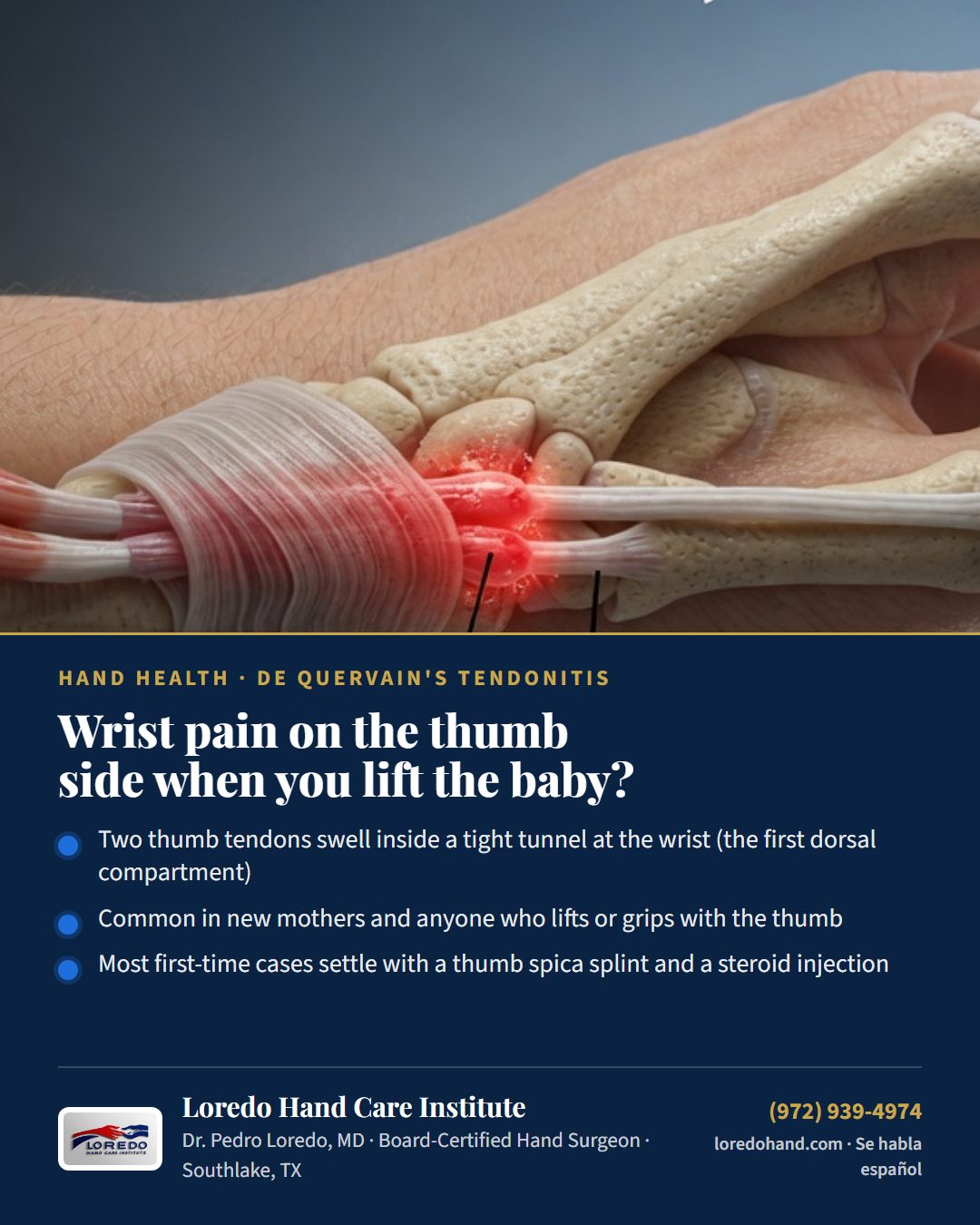 Wrist pain on the thumb side when you lift the baby? Loredo Hand Care Institute patient education card