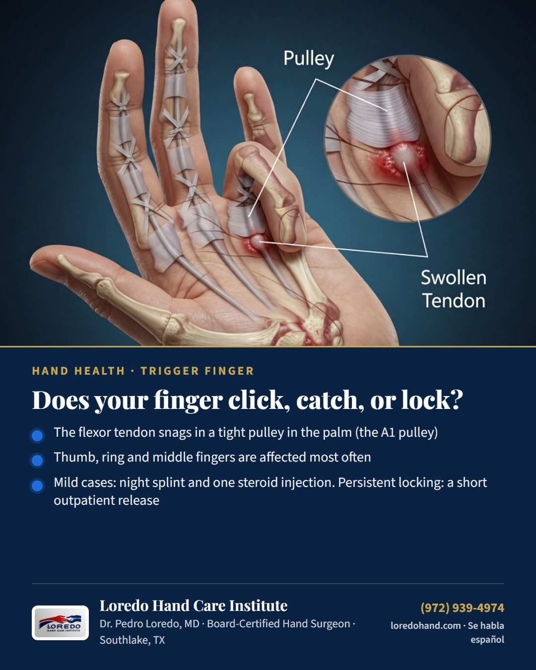 Does your finger click, catch, or lock? Loredo Hand Care Institute patient education card