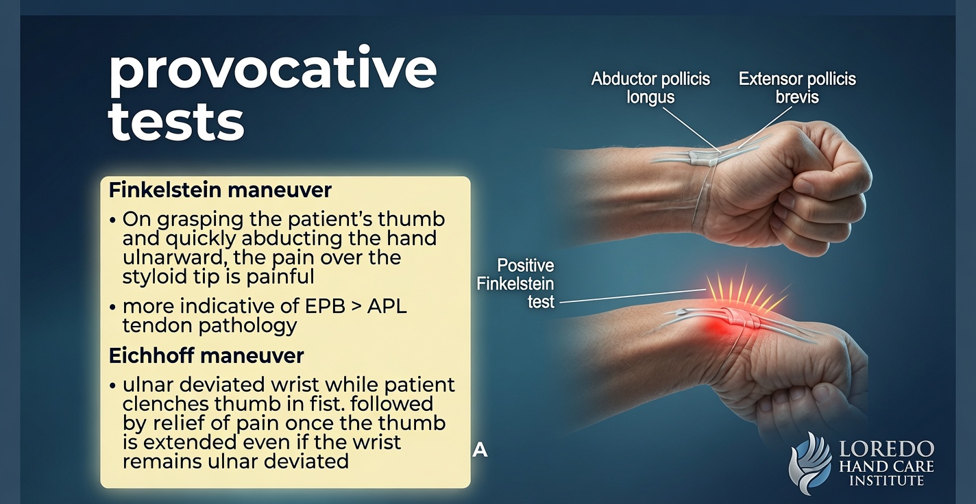 Eichhoff and Finkelstein provocative maneuvers compared, two clinical exam techniques used to diagnose De Quervain's tenosynovitis at the bedside